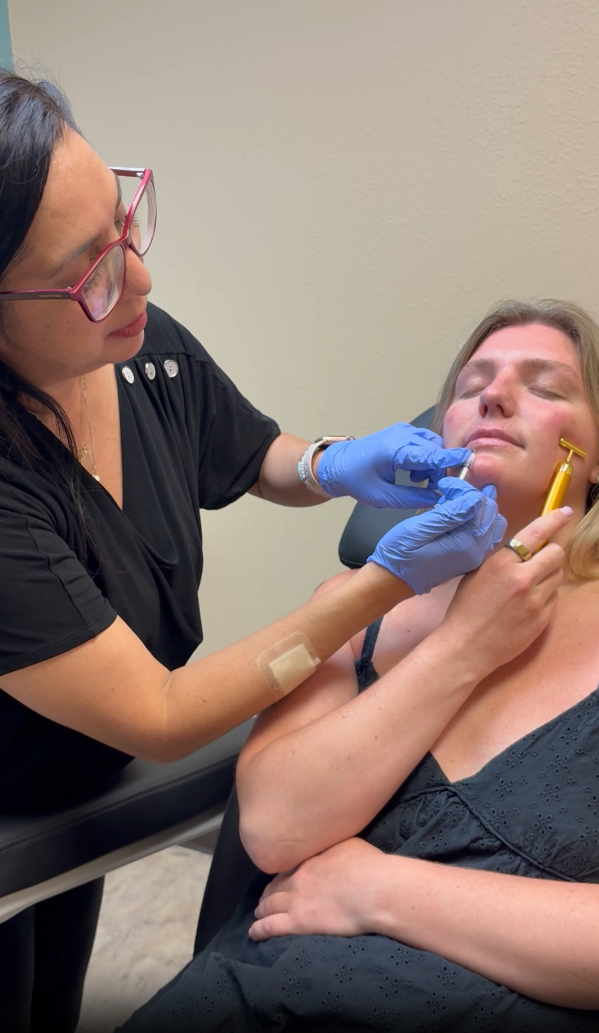 Botox Lip Flip After