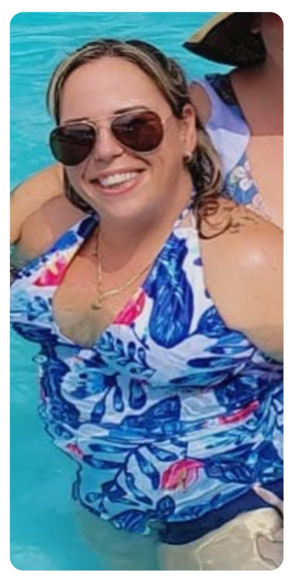 Medical Weight Loss Before