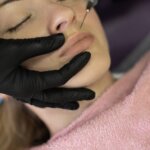 Lip Fillers Near Me: What to Expect for Fuller, Natural-Looking Lips