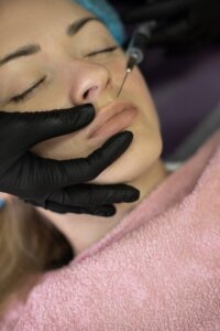 lip fillers near me