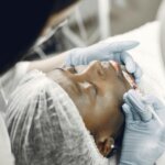 Expert Lip Filler After Care Tips for Long-Lasting Results