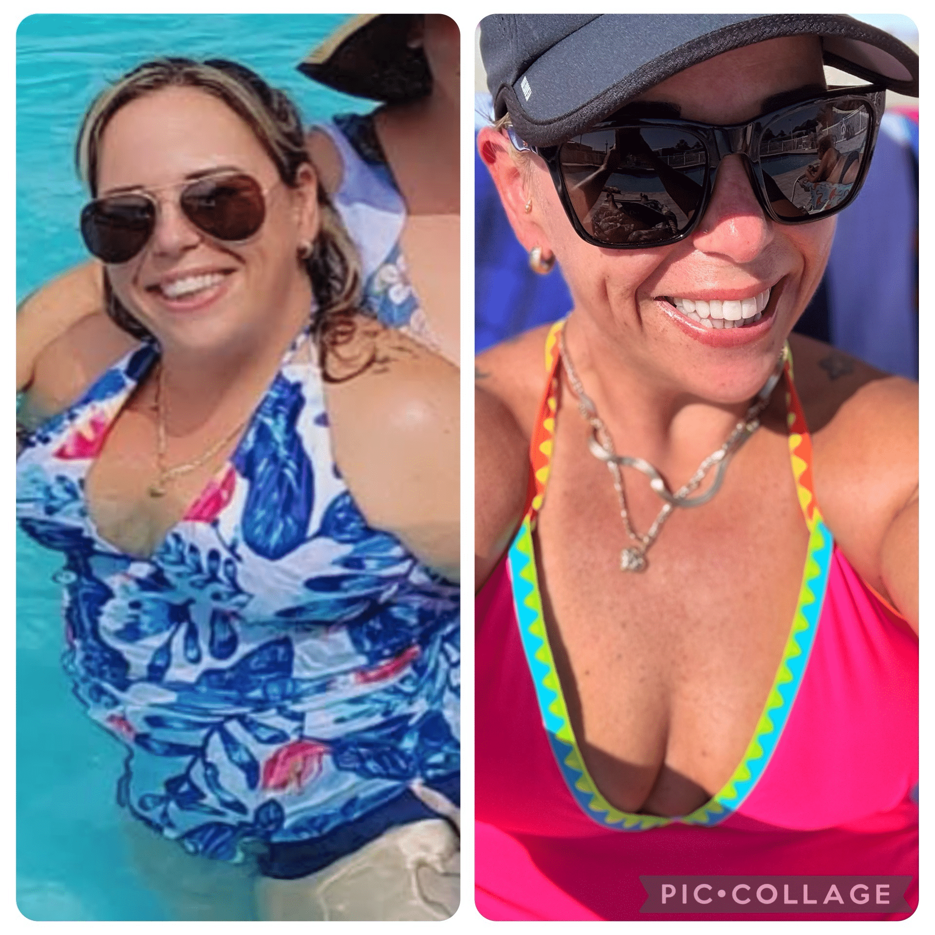 Before and After Image: Weight Loss - front