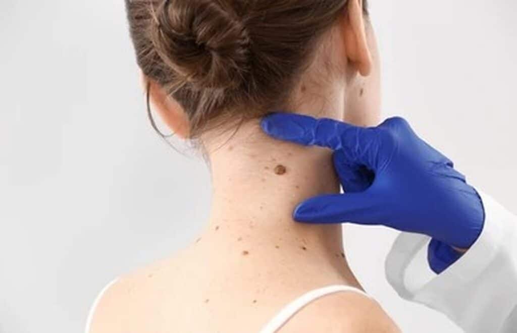 dermatology_high_quality_1920px A doctor looking at a mole on the back of a woman's neck during a DermaSensor exam